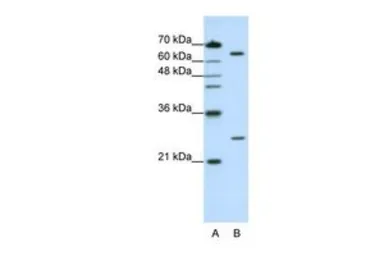 Anti-NUDT21 antibody, N-term used in Western Blot (WB). GTX47334