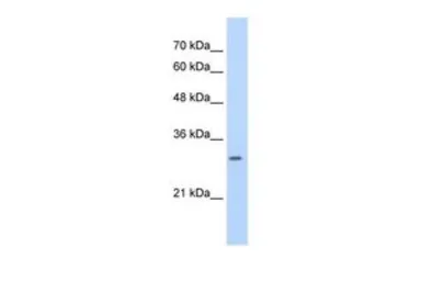 Anti-SLBP antibody, Internal used in Western Blot (WB). GTX47343