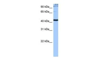 Anti-SFRS6 antibody, Internal used in Western Blot (WB). GTX47348