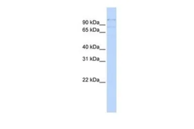 Anti-RBM12 antibody, Internal used in Western Blot (WB). GTX47352