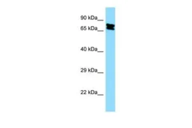 Anti-KHSRP antibody, Internal used in Western Blot (WB). GTX47379