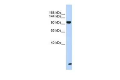 Anti-TNRC6B antibody, N-term used in Western Blot (WB). GTX47405