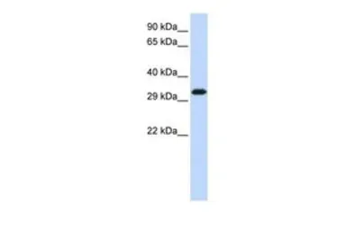 Anti-Gemin2 antibody, Internal used in Western Blot (WB). GTX47412