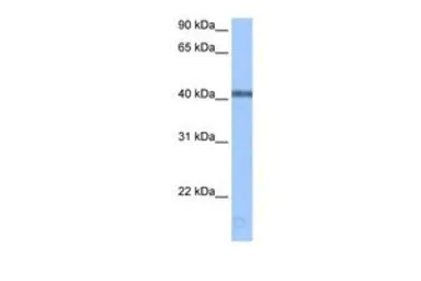 Anti-APOBEC3F antibody, Internal used in Western Blot (WB). GTX47415