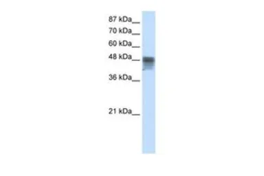 Anti-RBMS3 antibody, C-term used in Western Blot (WB). GTX47421