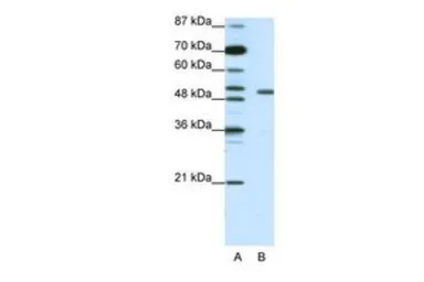 Anti-KCNAB2 antibody, Internal used in Western Blot (WB). GTX47447