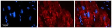 Anti-AKAP7 antibody, Internal used in IHC (Paraffin sections) (IHC-P). GTX47450