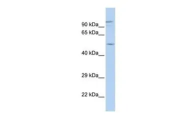 Anti-GJA3 antibody, N-term used in Western Blot (WB). GTX47482