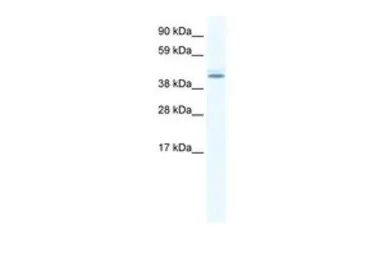 Anti-DDX49 antibody, N-term used in Western Blot (WB). GTX47505