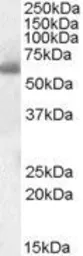 Anti-SH2D3A antibody, Internal used in Western Blot (WB). GTX47545
