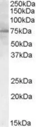 Anti-PCSK9 antibody, C-term used in Western Blot (WB). GTX47601