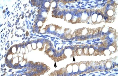 Anti-CLIC5 antibody, Internal used in IHC (Paraffin sections) (IHC-P). GTX47673