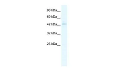 Anti-CLIC5 antibody, Internal used in Western Blot (WB). GTX47673