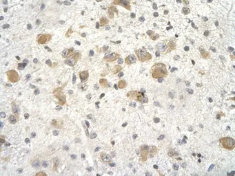 Anti-KCTD3 antibody, Internal used in IHC (Paraffin sections) (IHC-P). GTX47675