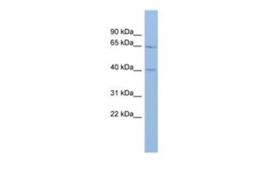 Anti-MLC1 antibody, Internal used in Western Blot (WB). GTX47676