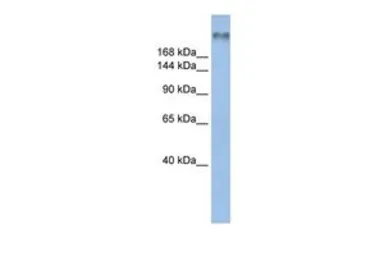 Anti-Nav1.6 antibody, Internal used in Western Blot (WB). GTX47678