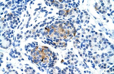 Anti-P2X1 antibody, Internal used in IHC (Paraffin sections) (IHC-P). GTX47691
