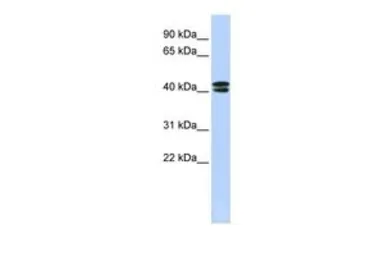 Anti-CACNB3 antibody, N-term used in Western Blot (WB). GTX47704
