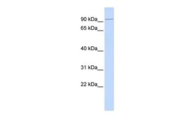 Anti-KIFC2 antibody, N-term used in Western Blot (WB). GTX47723
