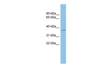 Anti-RALY antibody, Internal used in Western Blot (WB). GTX47775