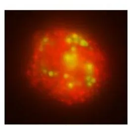 Anti-ACSL1 antibody, N-term used in Immunocytochemistry/ Immunofluorescence (ICC/IF). GTX47781