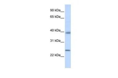 Anti-Claudin 7 antibody, C-term used in Western Blot (WB). GTX47786