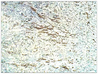 Anti-STRA6 antibody used in IHC (Paraffin sections) (IHC-P). GTX47858