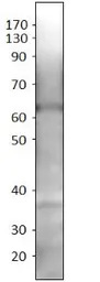 Anti-SLC7A10 antibody (N-terminal) used in Western Blot (WB). GTX47874