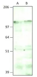 Anti-Aquarius antibody used in Western Blot (WB). GTX47914