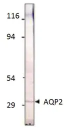 Anti-Aquaporin 2 antibody used in Western Blot (WB). GTX47923