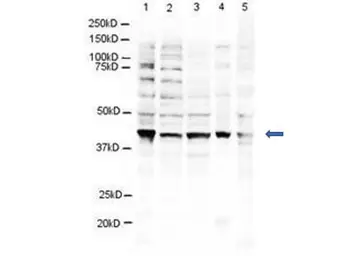 Anti-RNF2 antibody used in Western Blot (WB). GTX48486