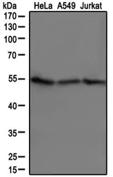 Anti-beta Tubulin antibody used in Western Blot (WB). GTX48617