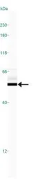 Anti-beta Tubulin antibody used in Western Blot (WB). GTX48617