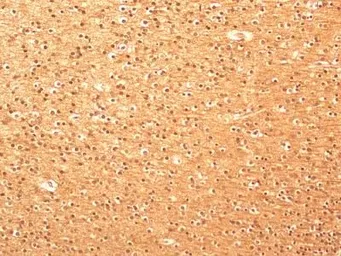 Anti-beta Tubulin antibody used in IHC (Paraffin sections) (IHC-P). GTX48617
