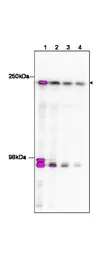 Anti-TAF1 antibody used in ChIP assay (ChIP assay). GTX48659