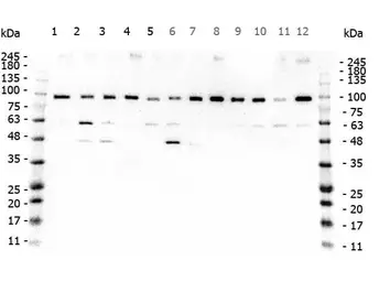 Anti-TAF1 antibody used in Western Blot (WB). GTX48659
