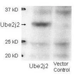 Anti-Ube2J2 antibody used in Western Blot (WB). GTX48692