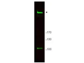 Anti-RIF1 antibody used in Western Blot (WB). GTX48737