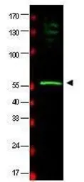 Anti-RAD23B antibody used in Western Blot (WB). GTX48751