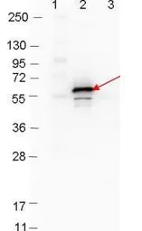 Anti-Dbp-B antibody used in Western Blot (WB). GTX48802