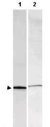 Anti-S100 antibody used in Western Blot (WB). GTX48819