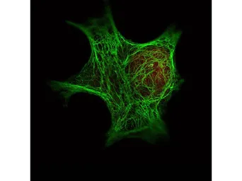 Anti-pan Cytokeratin antibody [C-11] used in Immunocytochemistry/ Immunofluorescence (ICC/IF). GTX48825