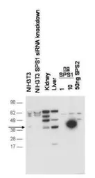 Anti-Selenophosphate synthetase 1 antibody used in Western Blot (WB). GTX48860
