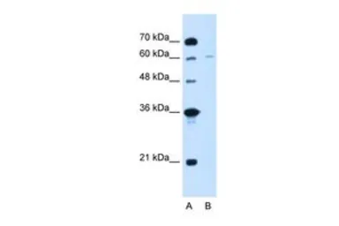 Anti-CHAF1B antibody, C-term used in Western Blot (WB). GTX48890