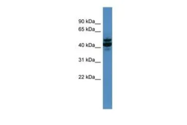Anti-ANTXR2 antibody, N-term used in Western Blot (WB). GTX48901