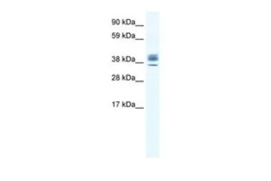Anti-ESX1 antibody, N-term used in Western Blot (WB). GTX48972