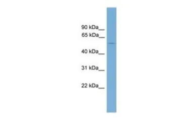 Anti-FOXD2 antibody, C-term used in Western Blot (WB). GTX48979