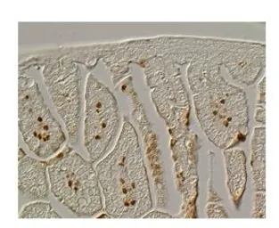 Anti-FOXF1 antibody, Internal used in IHC (Paraffin sections) (IHC-P). GTX48981