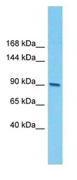 Anti-E2F7 antibody, N-term used in Western Blot (WB). GTX48989