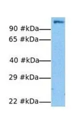 Anti-E2F7 antibody, N-term used in Western Blot (WB). GTX48989